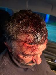 El Cadillal: violento asalto en la casa del propietario de la aerosilla conmociona a la zona
